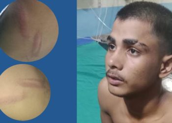 सिरहामा प्रधानाध्यापक सहित तीन जनाले विद्यार्थीलाई निर्घात कुटे