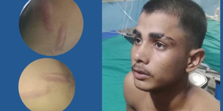 सिरहामा प्रधानाध्यापक सहित तीन जनाले विद्यार्थीलाई निर्घात कुटे